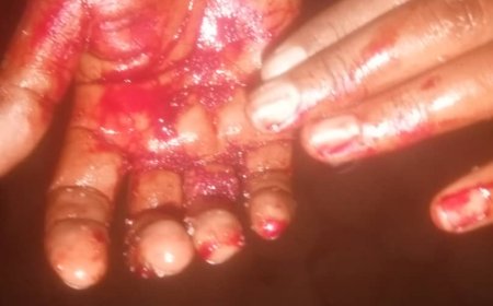 Huye: Inkuru ibabaje