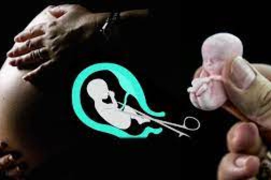 Sobanukirwa impamvu zishobora gutuma umuntu akuramo inda mu buryo bwemewe n’amategeko