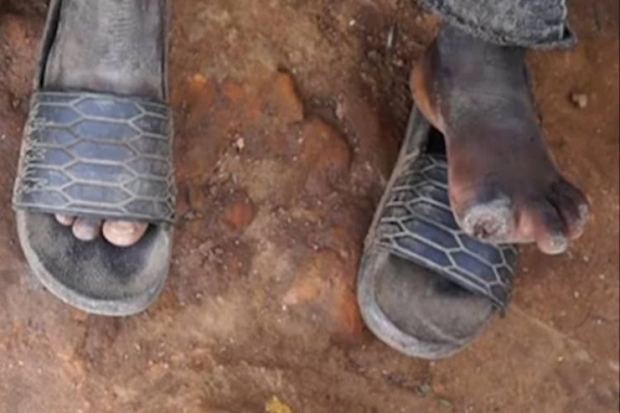 Mudugudu yatawe muri yombi igitaraganya azira guca amano abasore babiri bavukana babajura