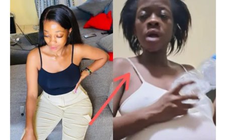 Ifoto y'umukobwa wari mwiza akaza kuba mubi nyuma yuko atwite akomeje gutuma abantu benshi banshika ururondogoro