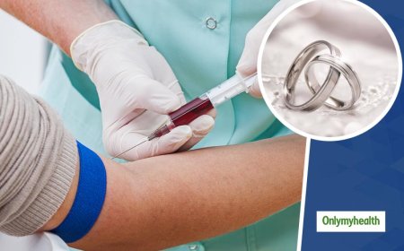 Dore Ibizamini by’ibanze abitegura kurushinga bagakwiye gukora mbere yo kubana