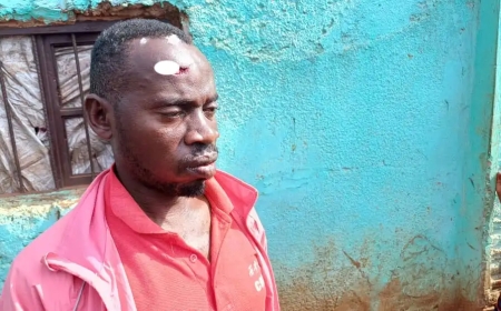 Muri Kayonza Uwatwikiwe iduka yongeye gukubitwa agirwa intere hafi nokubura ubuzima - [Reba inkuru mumashusho]