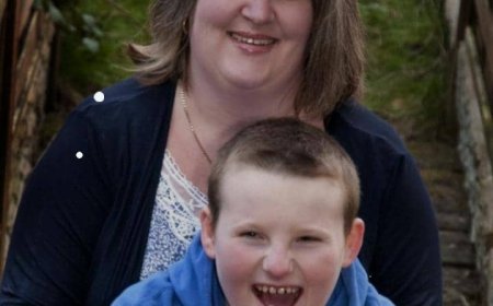 Byinshi wamenya ku ndwara ‘Smile Mask Syndrome’ ituma umuntu akunda guseka inseko z’uburyarya