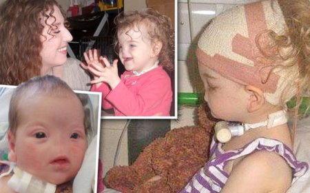 Byinshi wamenya kuri Tessa Evans wavutse nta mazuru afite ! Kuri ubu amaze kugira imyaka 10