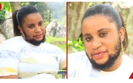 Birababaje nukuripe, Umukobwa ufite ubwanwa akomeje guhura n’imbogamizi zo kubura umukunzi