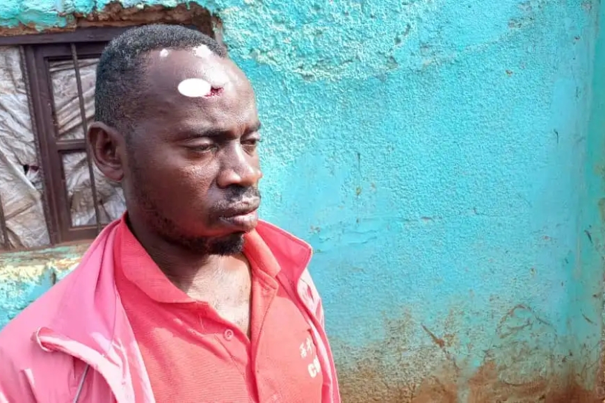 Muri Kayonza Uwatwikiwe iduka yongeye gukubitwa agirwa intere hafi nokubura ubuzima - [Reba inkuru mumashusho]