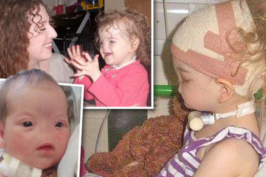 Byinshi wamenya kuri Tessa Evans wavutse nta mazuru afite ! Kuri ubu amaze kugira imyaka 10