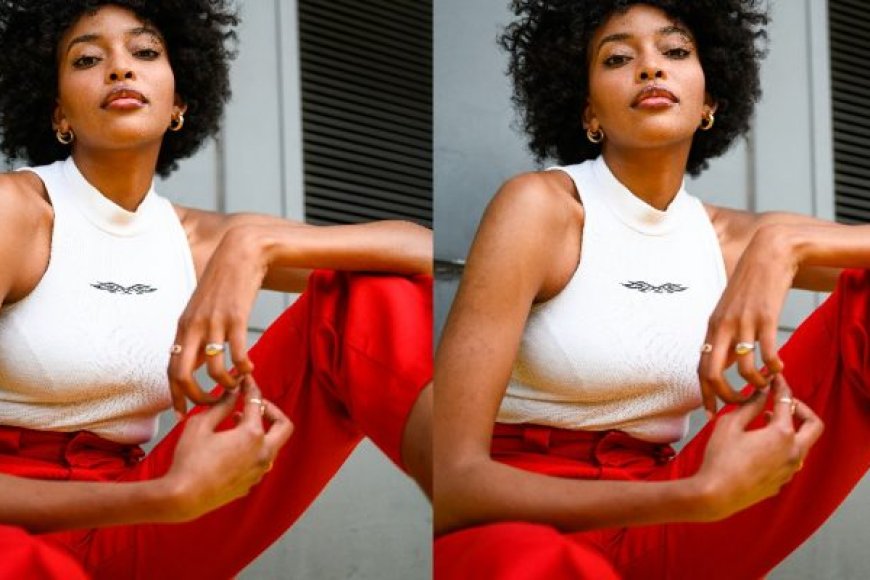 Byinshi wamenya ku indwara "Uterus Didelphys"  ituma umugore agira ibits1na bibiri na nyababyeyi ebyiri