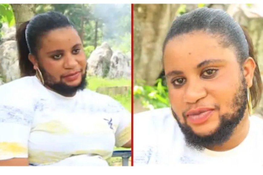 Birababaje nukuripe, Umukobwa ufite ubwanwa akomeje guhura n’imbogamizi zo kubura umukunzi