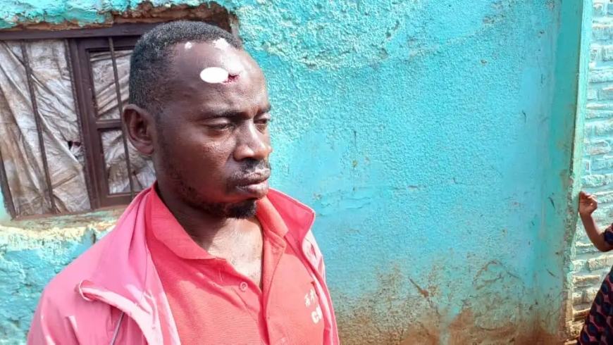 Muri Kayonza Uwatwikiwe iduka yongeye gukubitwa agirwa intere hafi nokubura ubuzima - [Reba inkuru mumashusho]