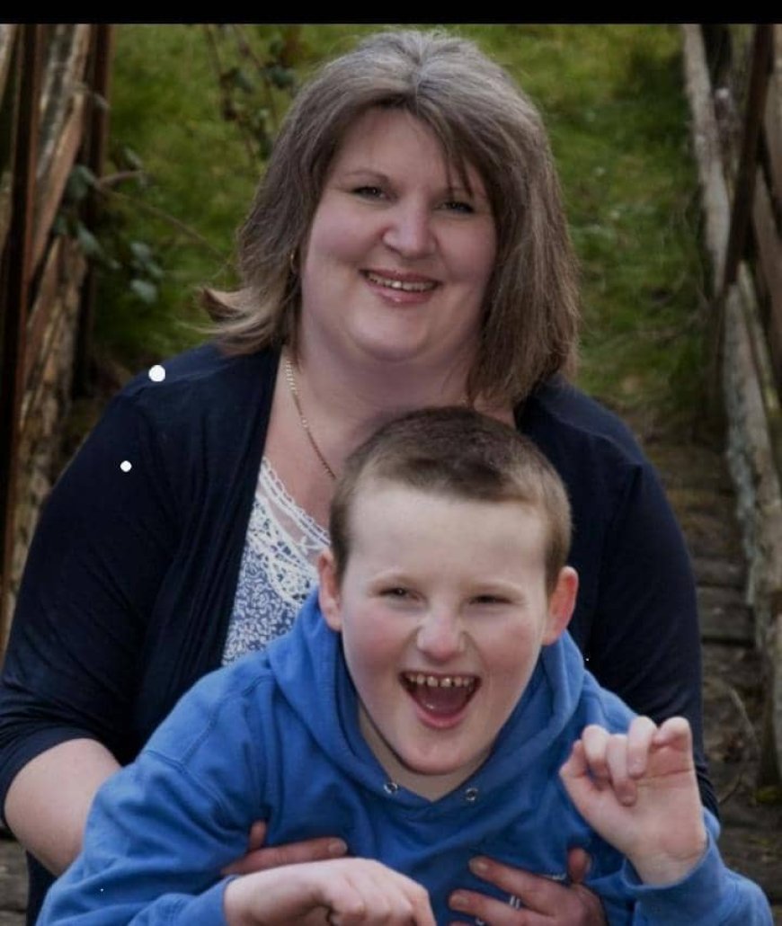 Byinshi wamenya ku ndwara ‘Smile Mask Syndrome’ ituma umuntu akunda guseka inseko z’uburyarya