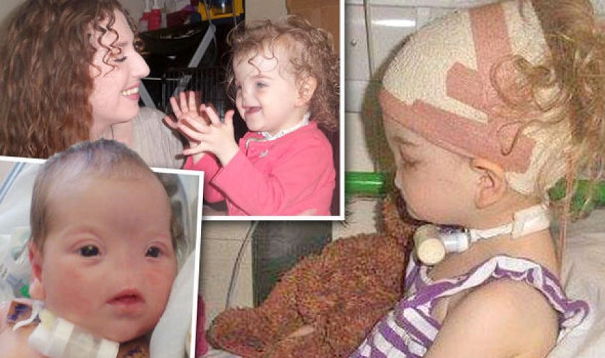 Byinshi wamenya kuri Tessa Evans wavutse nta mazuru afite ! Kuri ubu amaze kugira imyaka 10