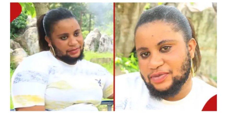 Birababaje nukuripe, Umukobwa ufite ubwanwa akomeje guhura n’imbogamizi zo kubura umukunzi