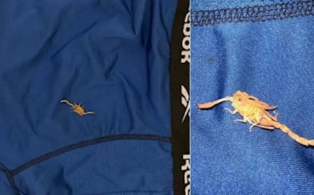 Umugabo ari kurega hoteli yacumbitsemo mu ijoro avuga ko yarumwe na sikorupiyo ku myanya ye y’ibanga asinziriye muri hoteli