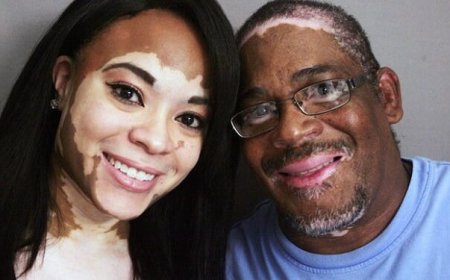 Bihagarike igitaraganya amavuta twisiga ashobora gutera kanseri