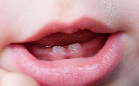 Ese bigenda bite ngo uruhinja ruvukane amenyo? Sobanukirwa impamvu yabyo