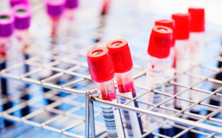 Sobanukirwa impamvu ubungubu HIV/SIDA yavanwa mu muntu burundu