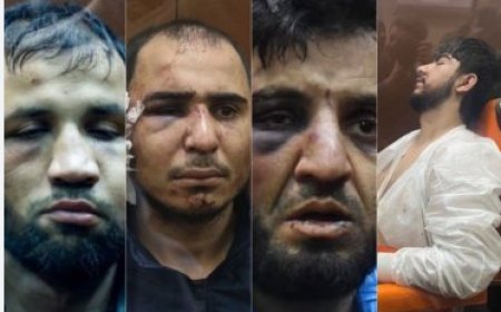 Putin yahaye isomo abakekwaho kumukora mu jisho bamugabaho ibitero, byahaye isomo ibindi byihebe byose