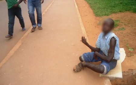 Amakuru mashya: Ubuyobozi bw’abafite ubumuga mu Rwanda bwagaragaje ikibazo bwahagurukiye ariko kitarakemuka uko byifuzwa