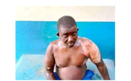 Nigeria: Umugabo warumaze iminsi mike arongoye ,umugore we yamusutseho amazi ashyushye