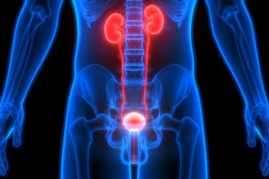 Dore ibyo ukwiye kwitaho mu gihe inkari zawe zahinduye ibara, nuburyo wabyirinda