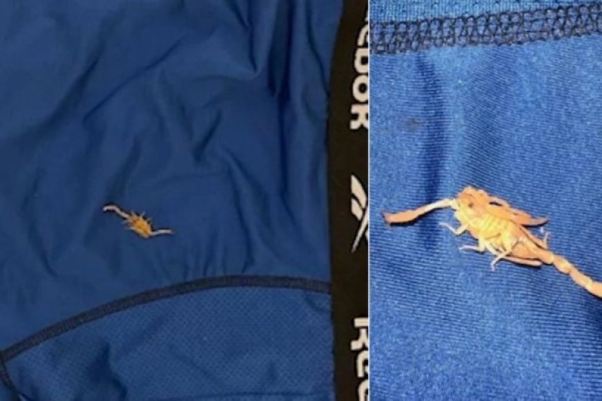 Umugabo ari kurega hoteli yacumbitsemo mu ijoro avuga ko yarumwe na sikorupiyo ku myanya ye y’ibanga asinziriye muri hoteli