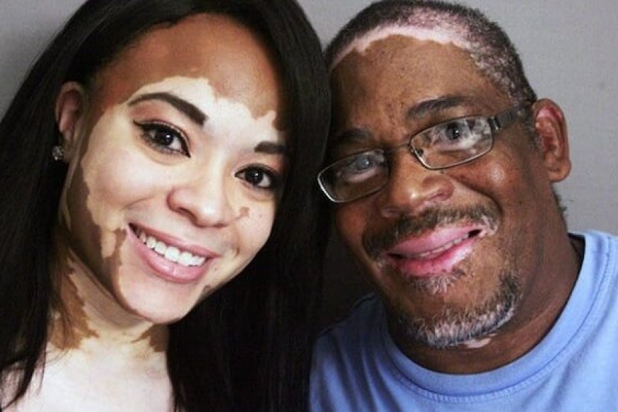 Bihagarike igitaraganya amavuta twisiga ashobora gutera kanseri