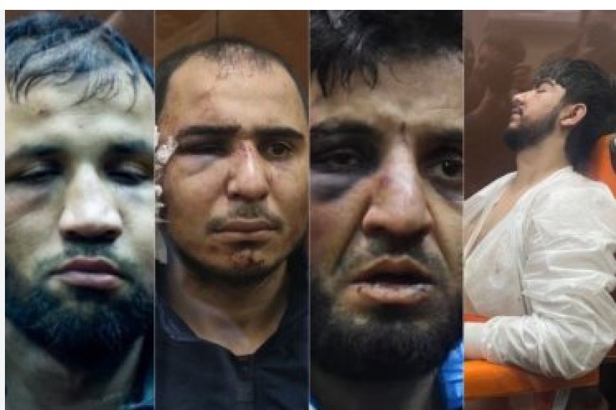 Putin yahaye isomo abakekwaho kumukora mu jisho bamugabaho ibitero, byahaye isomo ibindi byihebe byose