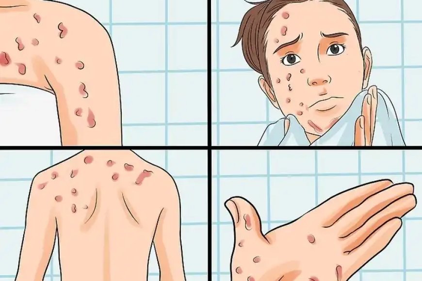 Nubona ibi bimenyetso uzamenye ko ushobora kuba waranduye SIDA utabizi