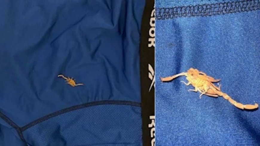 Umugabo ari kurega hoteli yacumbitsemo mu ijoro avuga ko yarumwe na sikorupiyo ku myanya ye y’ibanga asinziriye muri hoteli