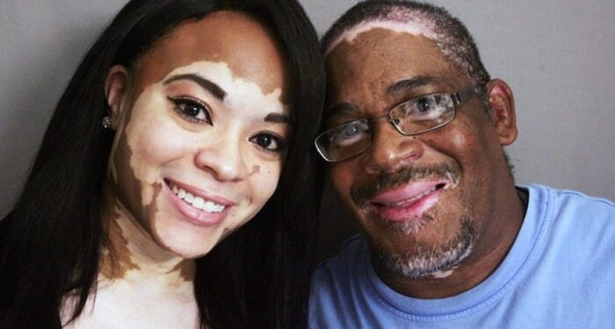 Bihagarike igitaraganya amavuta twisiga ashobora gutera kanseri