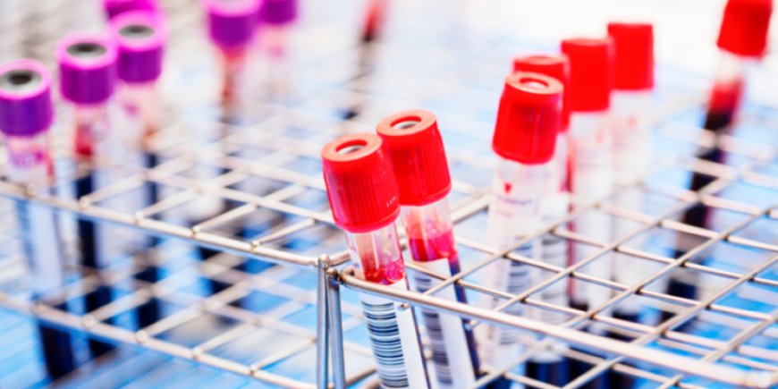 Sobanukirwa impamvu ubungubu HIV/SIDA yavanwa mu muntu burundu