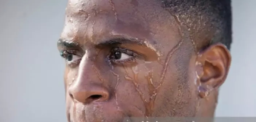 Ese wari uzi ko kubira ibyuya byinshi ari indwara? Sobanukirwa