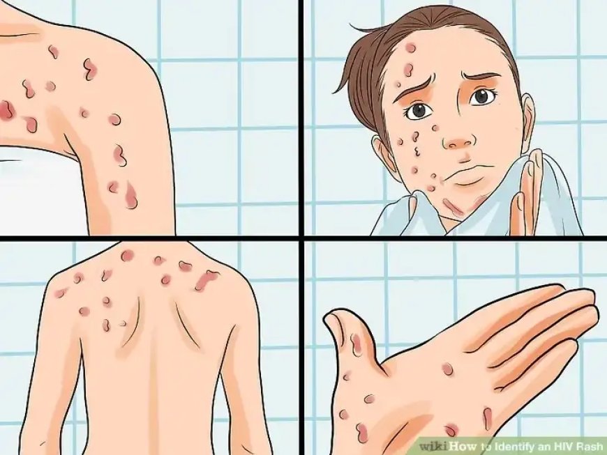 Nubona ibi bimenyetso uzamenye ko ushobora kuba waranduye SIDA utabizi