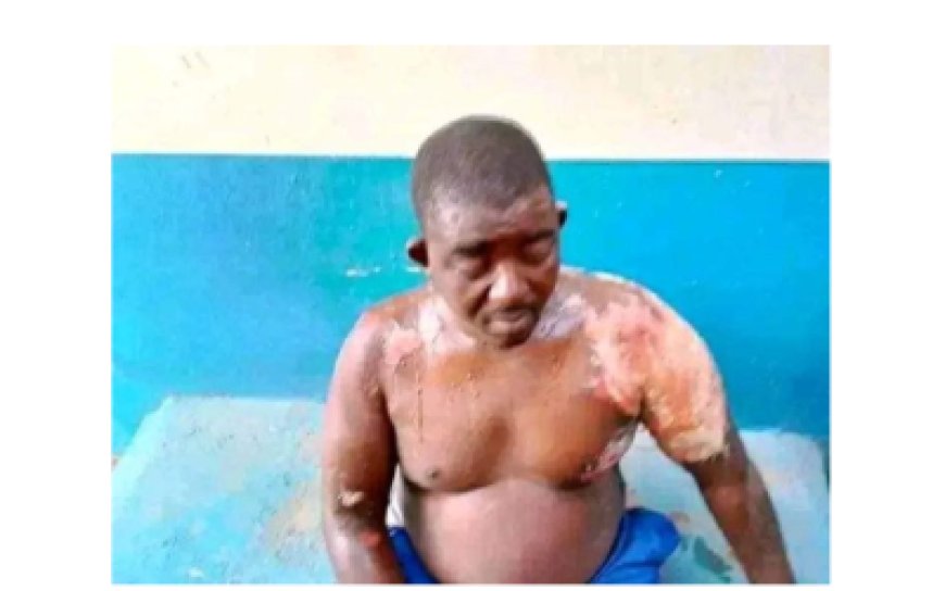 Nigeria: Umugabo warumaze iminsi mike arongoye ,umugore we yamusutseho amazi ashyushye