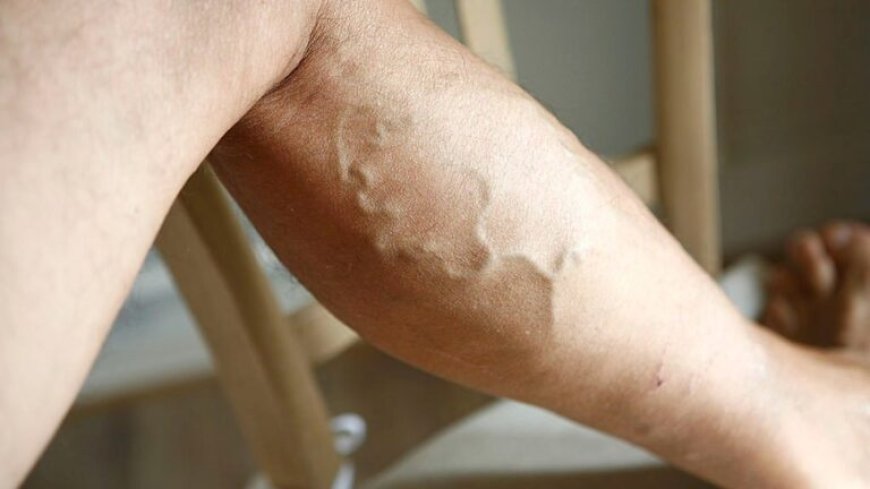 Uhutire kujya kwa muganga utarapfa! Bivuze iki iyo imitsi yawe itangiye kumera gutya?