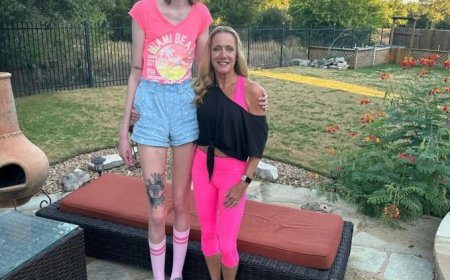 Umukobwa ufite amaguru maremare kurusha abandi ku Isi yavuze agahinda ahura nako[AMAFOTO]