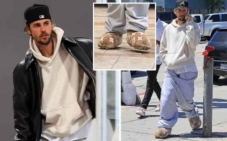 Nyuma y'iminsi myinshi atagaragara Justin Bieber yatunguranye ku karubanda yambaye inkweto zidasanzwe zigura arenga miliyoni 4 [AMAFOTO]