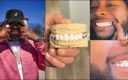 Umuhanzi Davido yaguze amenyo ahagaze akayabo ka Miliyoni 258 RWF[AMAFOTO]