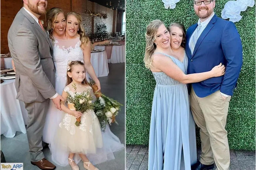 Wakwibaza ngo batera akabariro gute? Urujijo ku mpanga zavutse zifatanye zashatse umugabo muri Amerika[AMAFOTO]