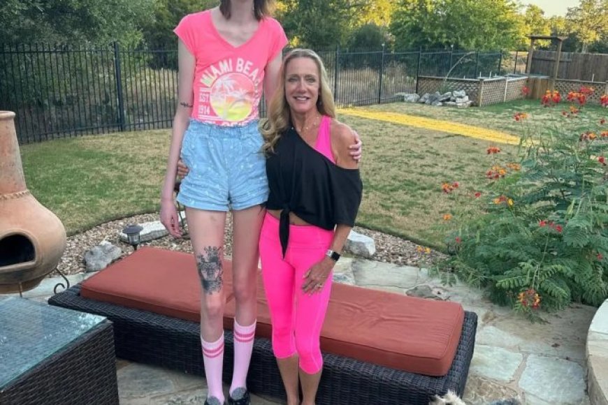 Umukobwa ufite amaguru maremare kurusha abandi ku Isi yavuze agahinda ahura nako[AMAFOTO]