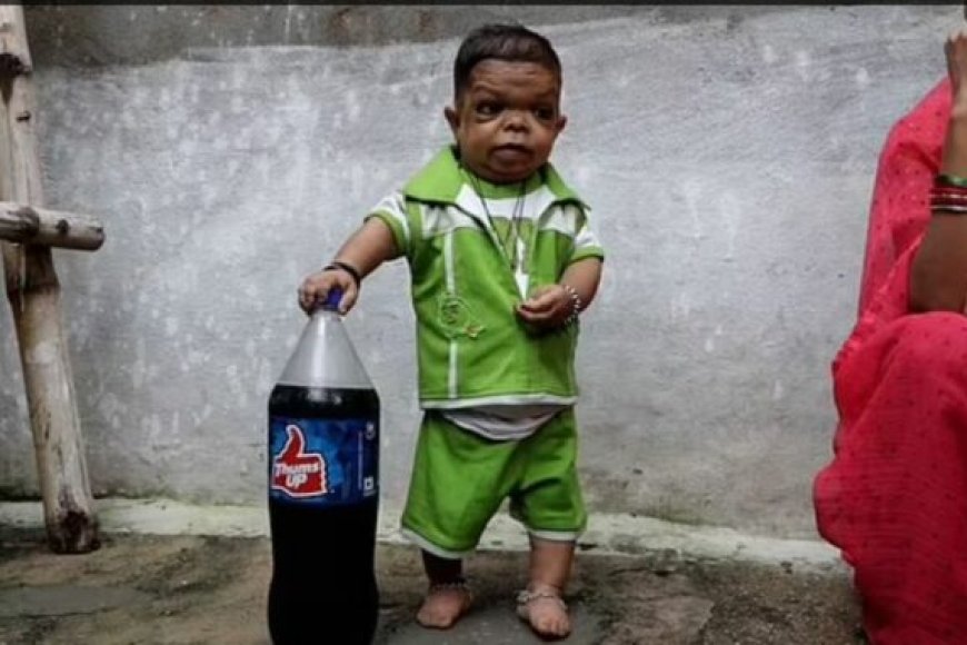 Afite imyaka 25 ariko mama we agenda amuteruye! Ravi Kumar umugabo warekeyaho gukura ku myaka 5 gusa[AMAFOTO]