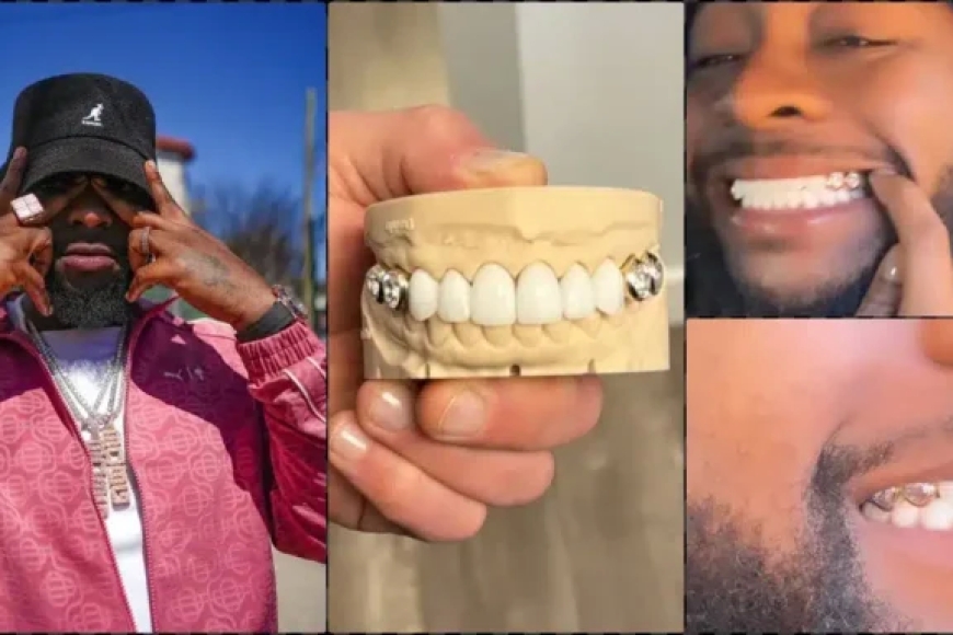 Umuhanzi Davido yaguze amenyo ahagaze akayabo ka Miliyoni 258 RWF[AMAFOTO]