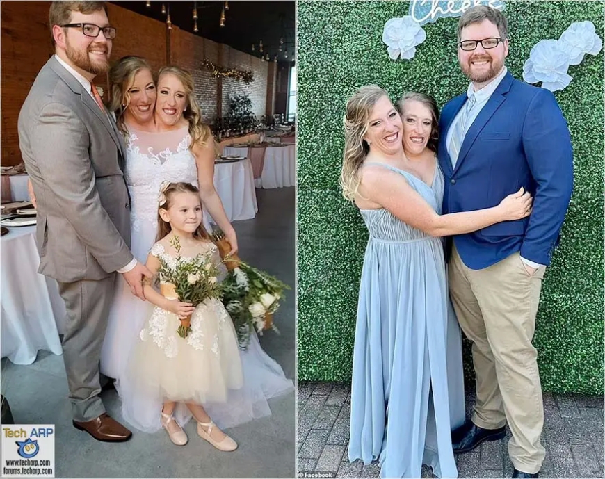 Wakwibaza ngo batera akabariro gute? Urujijo ku mpanga zavutse zifatanye zashatse umugabo muri Amerika[AMAFOTO]