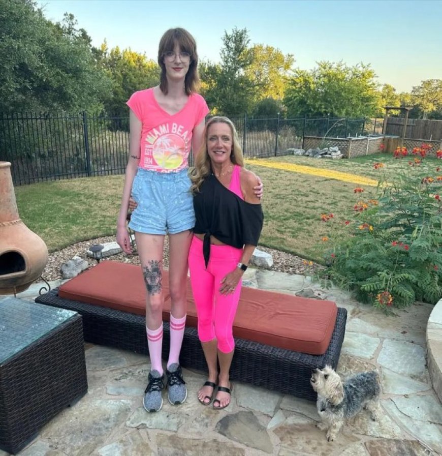 Umukobwa ufite amaguru maremare kurusha abandi ku Isi yavuze agahinda ahura nako[AMAFOTO]