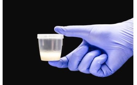 Impungenge ku bana 600 bavutse ku bagabo batatu, bagasanganwa ikibazo gikomeye, biturutse kuntanga zatanzwe