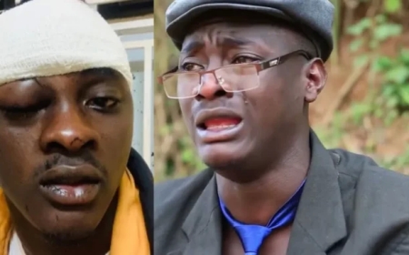 Umunyarwenya ugezweho mu Rwanda Dogiteri Nsabii yagaragaje uko impanuka yamusize[AMAFOTO]