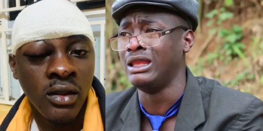 Umunyarwenya ugezweho mu Rwanda Dogiteri Nsabii yagaragaje uko impanuka yamusize[AMAFOTO]