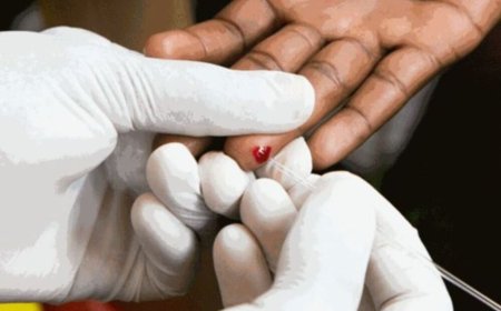 Uganda: Imibare y’abandura virusi itera SIDA ikomeje gutumbagira ndetse ikomeje guhita benshi