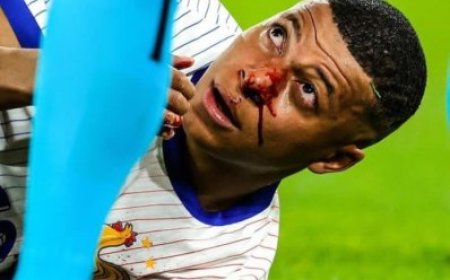 Rutahizamu ukomeye cyane Kylian Mbappe  hamenyekanye icyemezo cyafashwe nyuma yo kuvunika izuru